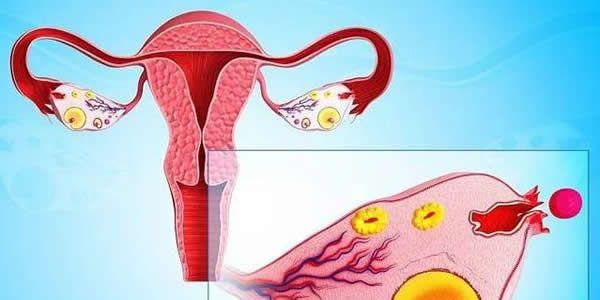 没有卵巢可以做试管婴儿吗 女性没有卵巢还能生孩子吗