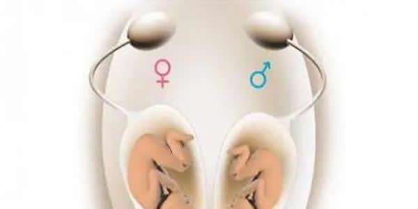 做试管婴儿生男孩的几率大吗？生殖医生答疑