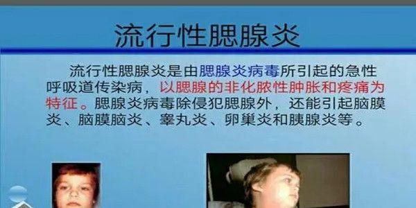 听说小时候腮腺炎会影响生育，是真的吗？