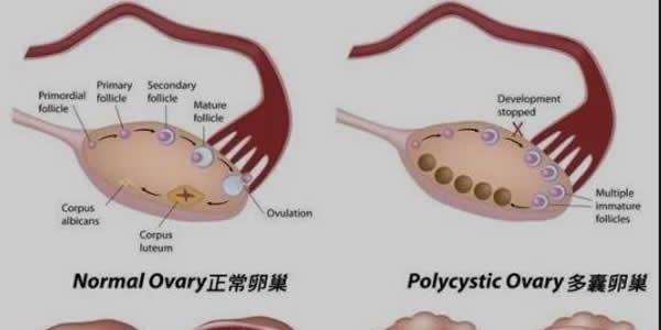 AMH值0.7还能自然怀孕吗