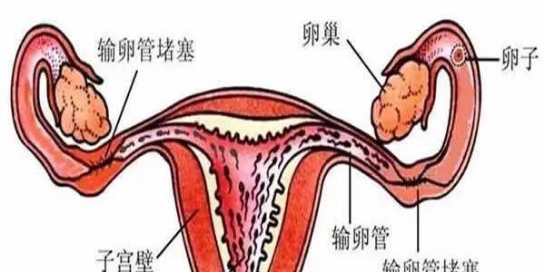 输卵管堵塞的症状