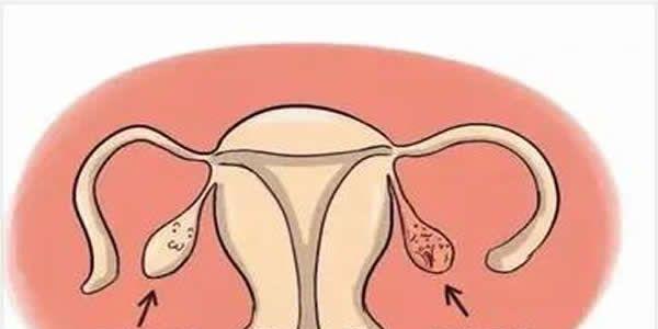 卵巢早衰可以做供(借)卵试管婴儿吗?成功率有多少