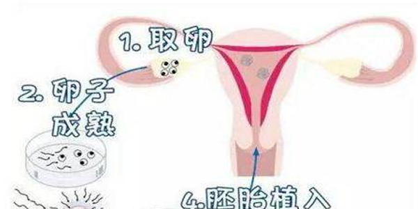 试管婴儿最难的那一关环节在哪里