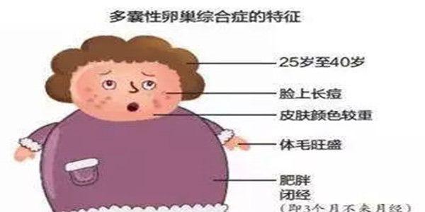 多囊卵巢综合症是不治之症吗？