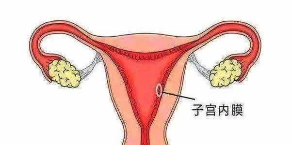 子宫内膜准备
