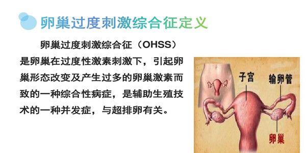 试管婴儿常见的并发症有哪些