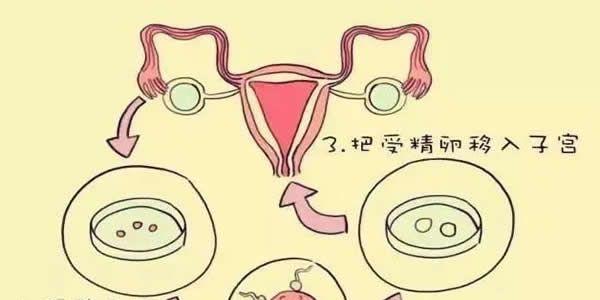  女性年龄对试管婴儿成功率的影响   高龄如何提高试管婴儿成功率