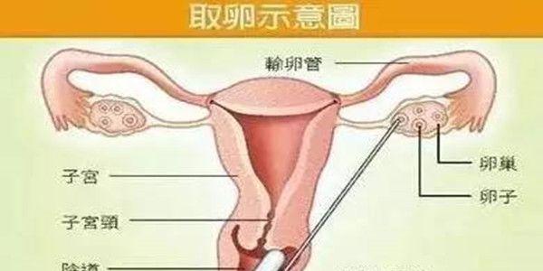 取卵后月经推迟的原因