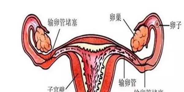 输卵管不通做试管成功率多少