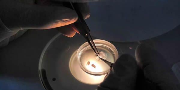 女人做试管过程痛苦吗  图解试管婴儿流程  