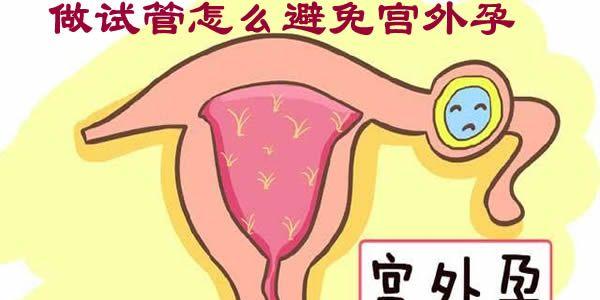 src=http___n.sinaimg.cn_front_224_w640h384_20181202_oLKg-hpinryc0922291.jpg&refer=http___n.sinaimg.jpg