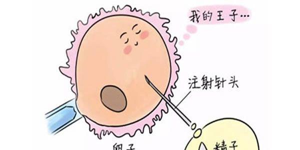 对比一到三代试管婴儿的优缺点-专家详解