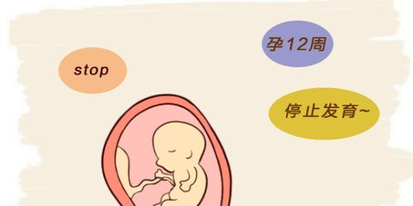预防胚胎停育的十个注意事项