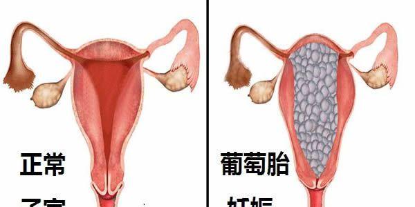 怀孕初期血值多少正常-怀孕后血hcg正常值参考范围表 