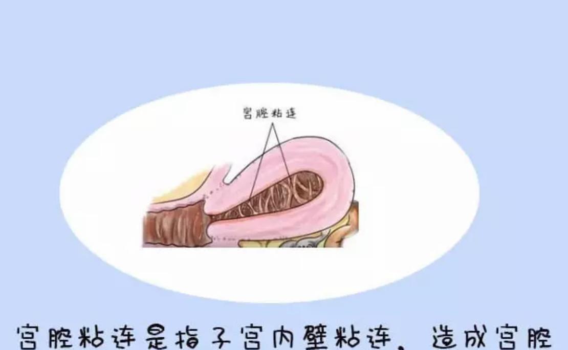 6种导致少女月经推迟的原因资料整理