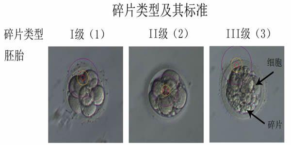试管婴儿三级胚胎可以移植吗