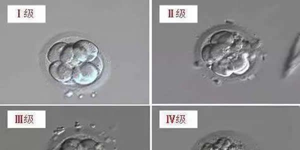 试管婴儿三级胚胎可以移植吗
