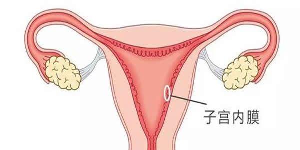 子宫内膜薄会造成不孕吗