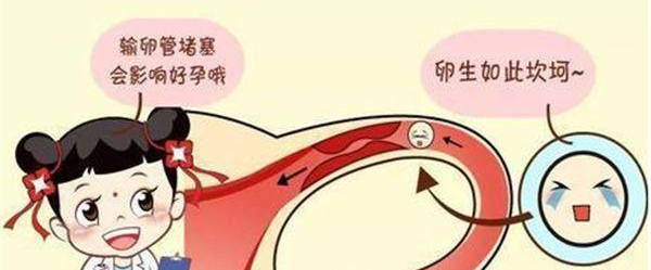 输卵管疾病导致女性不孕的5大因素-汇总分享