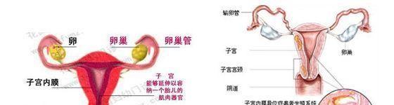 动漫解析子宫内膜异位症是如何形成的