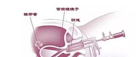 无排卵性不孕症的检查项目有哪些-专项检查有4种