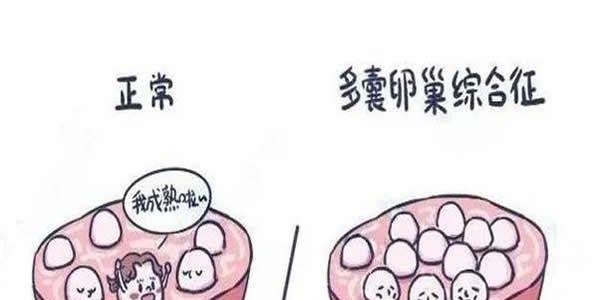 多囊卵巢做试管婴儿前的注意事项