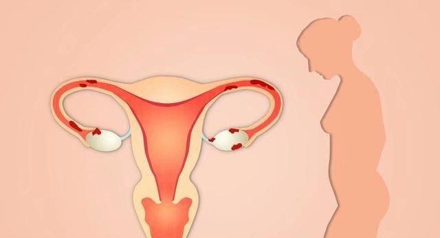 试管婴儿女性这12项检查，你知道几个？