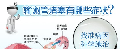 输卵管梗阻