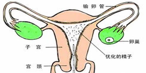 人工受精的流程及费用