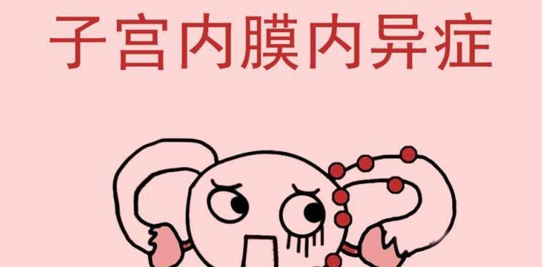 哪些人需要做试管婴儿？这女四男二建议尝试一下