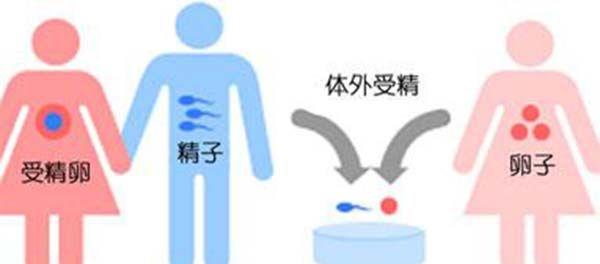 国外试管婴儿试管婴儿流程步骤