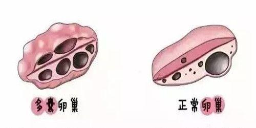 做试管婴儿妈妈会有后遗症吗？做试管婴儿的后遗症主要有这4种