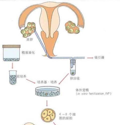 详细分析三代试管婴儿的各自优缺点，患者可根据自身需求选择