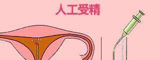 什么人适合做试管婴儿？这4类人一定要尝试！