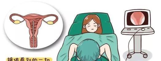 如何治疗宫腔粘连