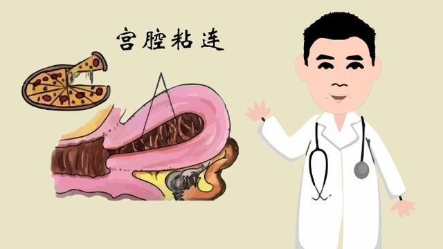 宫腔粘连产生的原因是什么怎么治