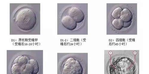 试管养囊失败的原因