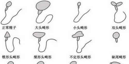 试管养囊失败的原因