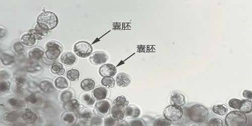 试管养囊失败的原因