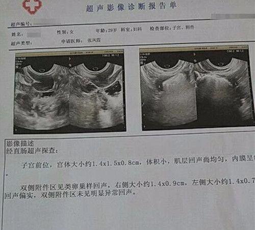 幼稚子宫的形成原因