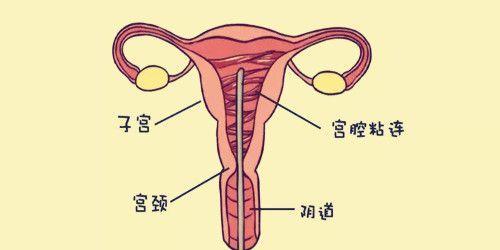 宫腔粘连医学图解