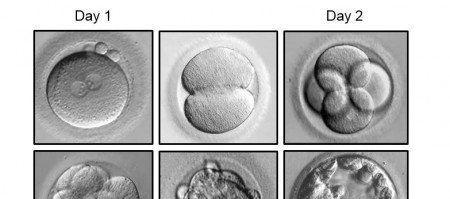 胚胎每天发育图