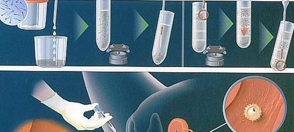 试管婴儿流程六个步骤图