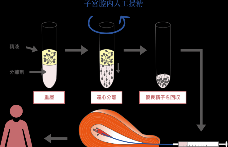 人工授精过程图