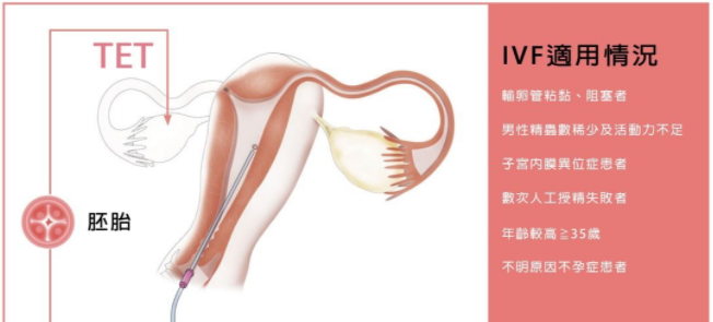 试管婴儿流程图