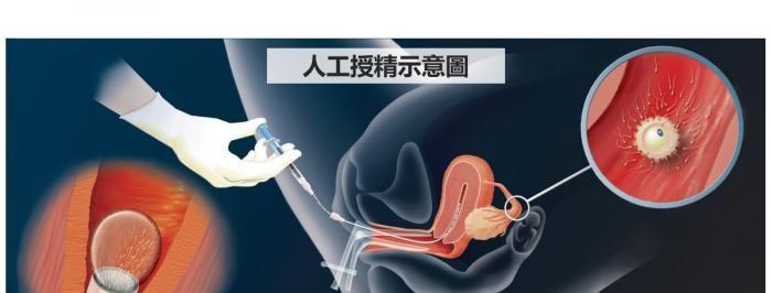人工受精示意图.jpg