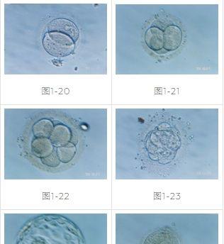 胚胎图片