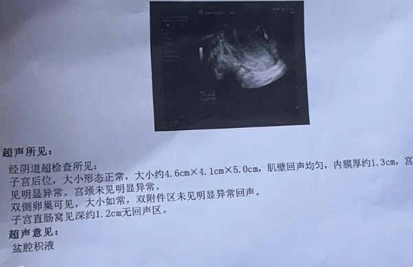 b超检查可以判断宫腔环境