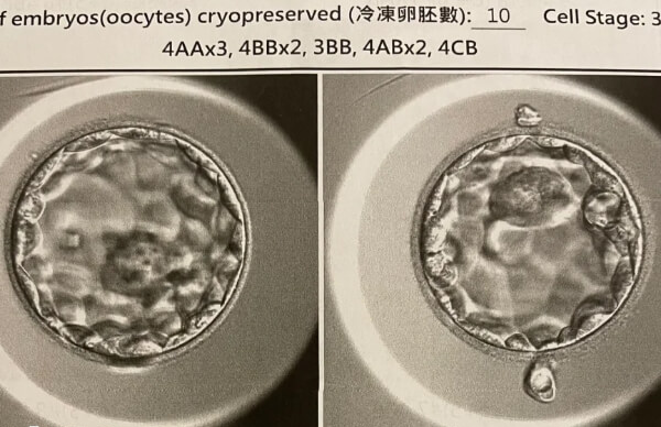 囊胚着床速度快