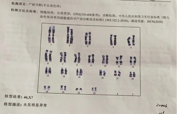 羊水穿刺染色体异常需要做彩超检查